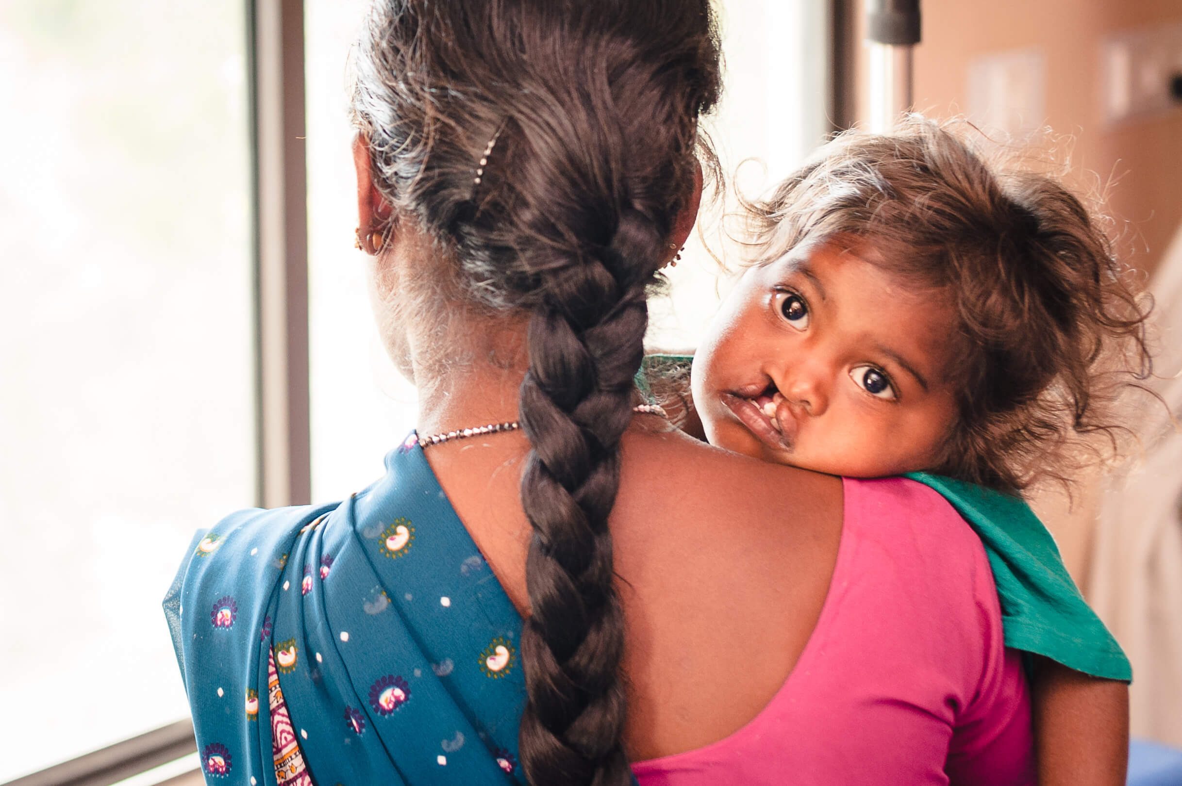 Cleft operation indien 10