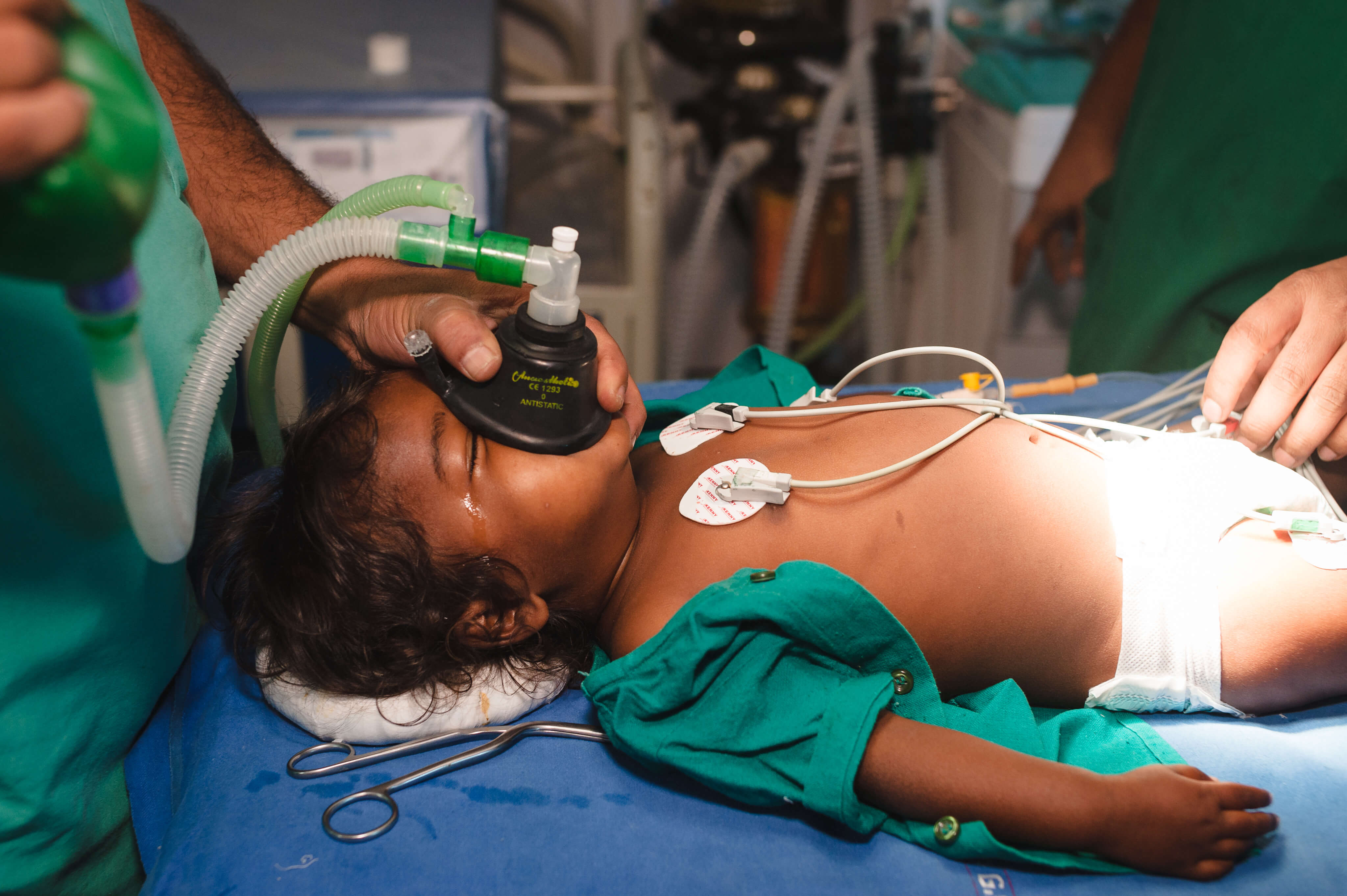 Cleft operation indien 13
