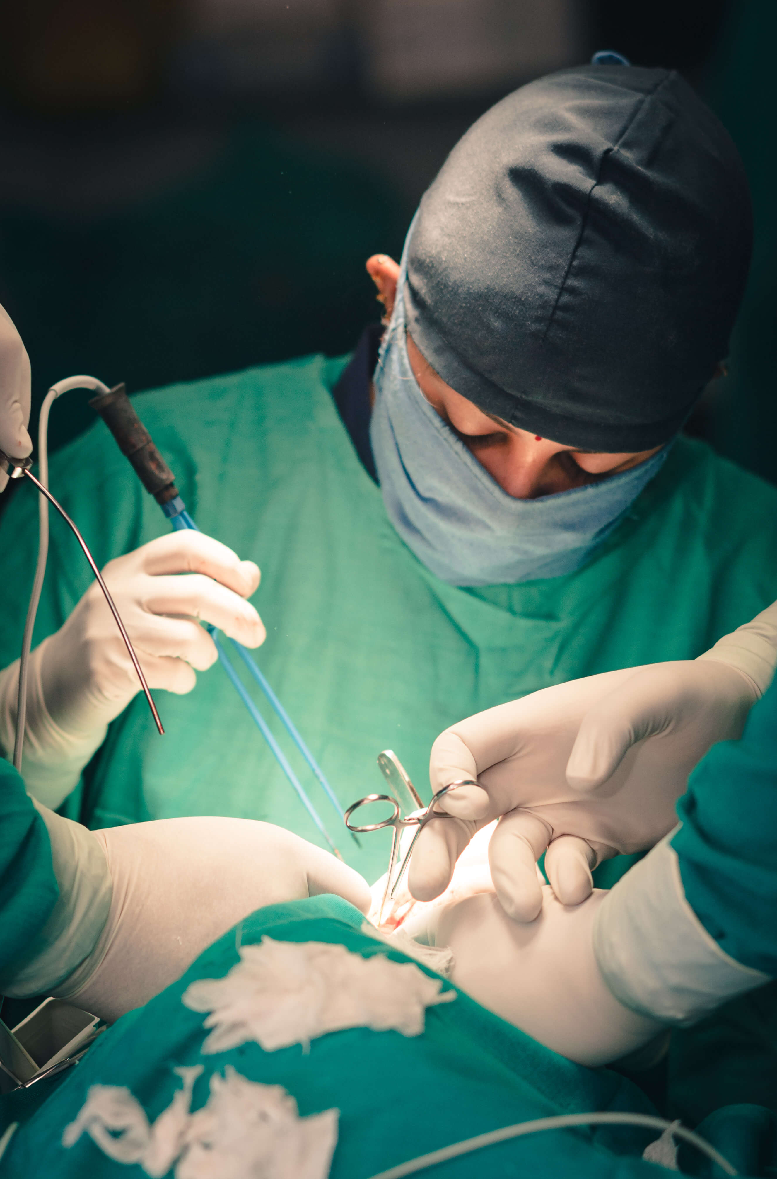Cleft operation indien 14