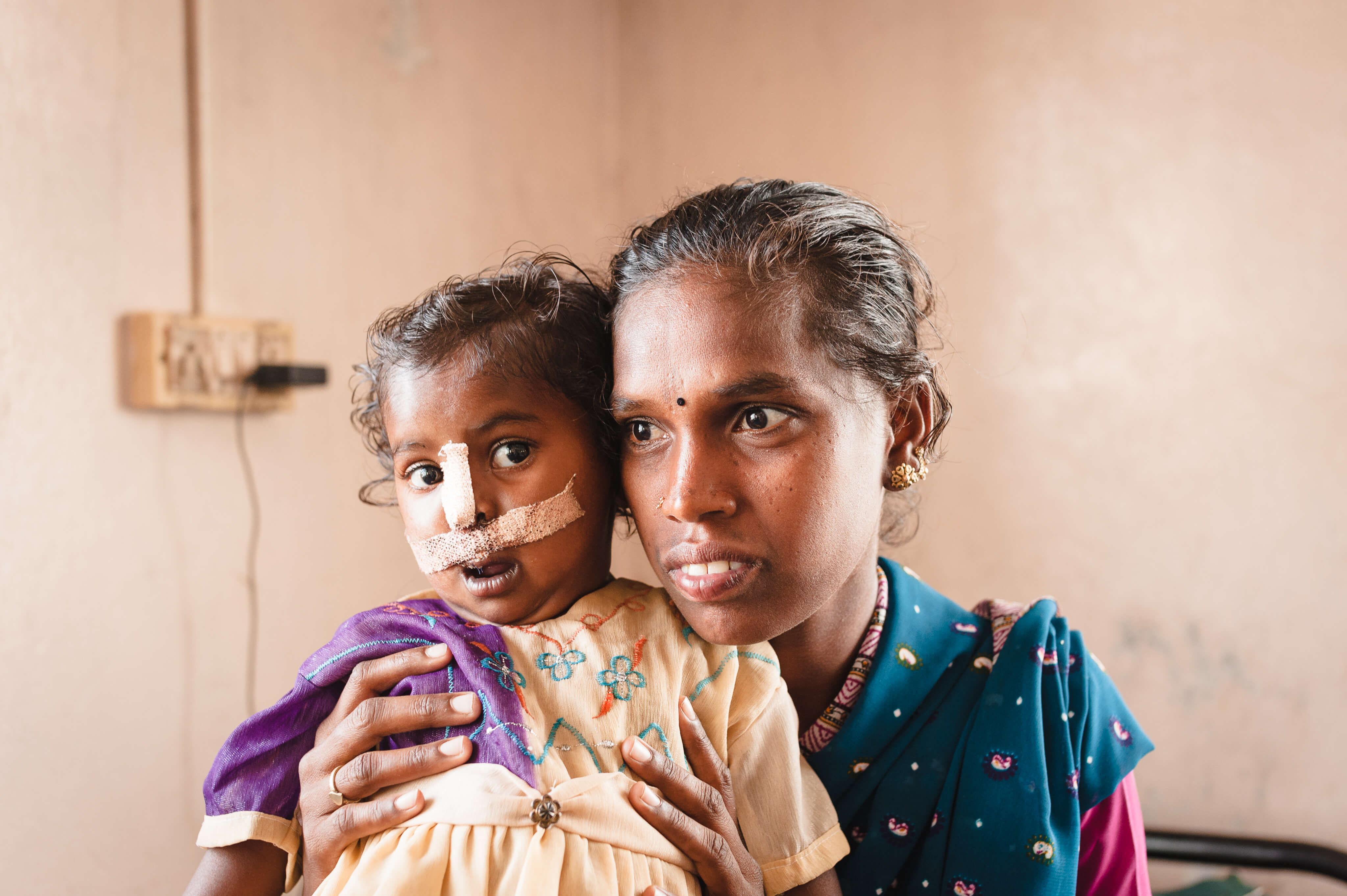 Cleft operation indien 16