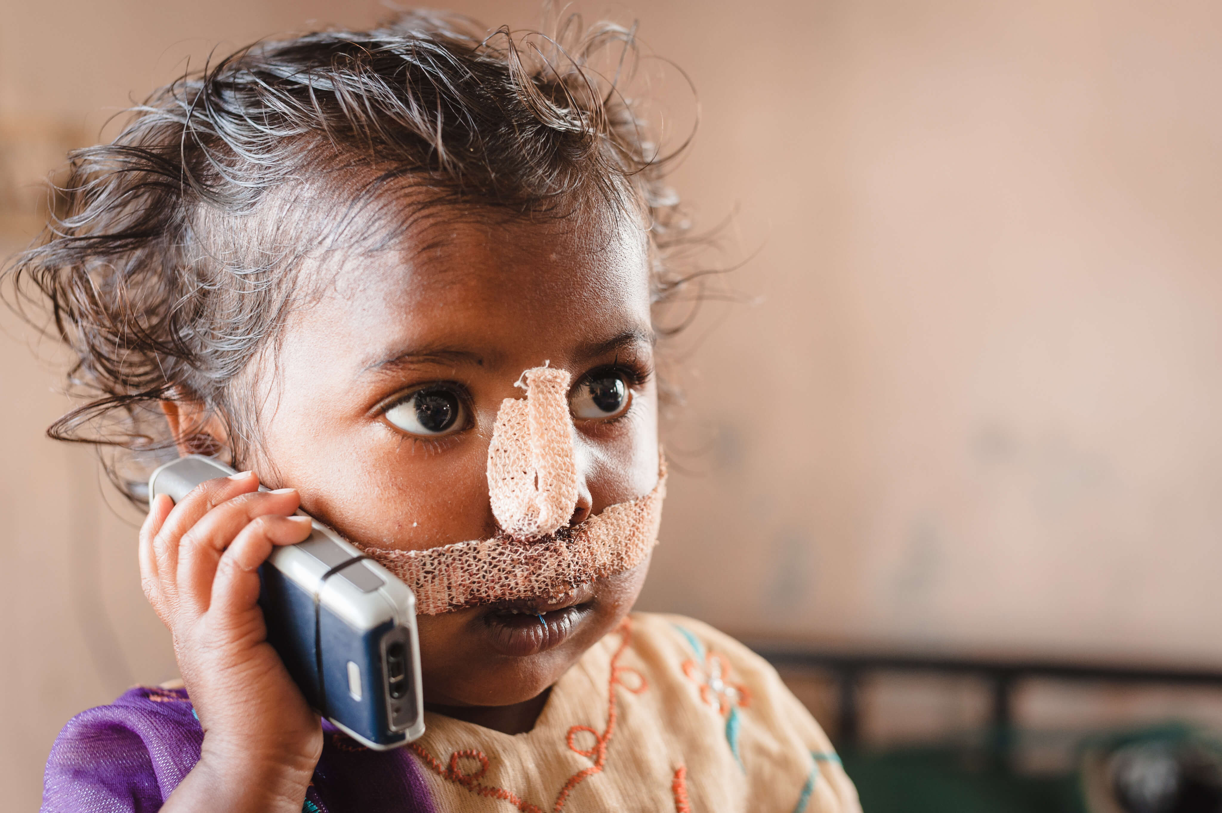 Cleft operation indien 17