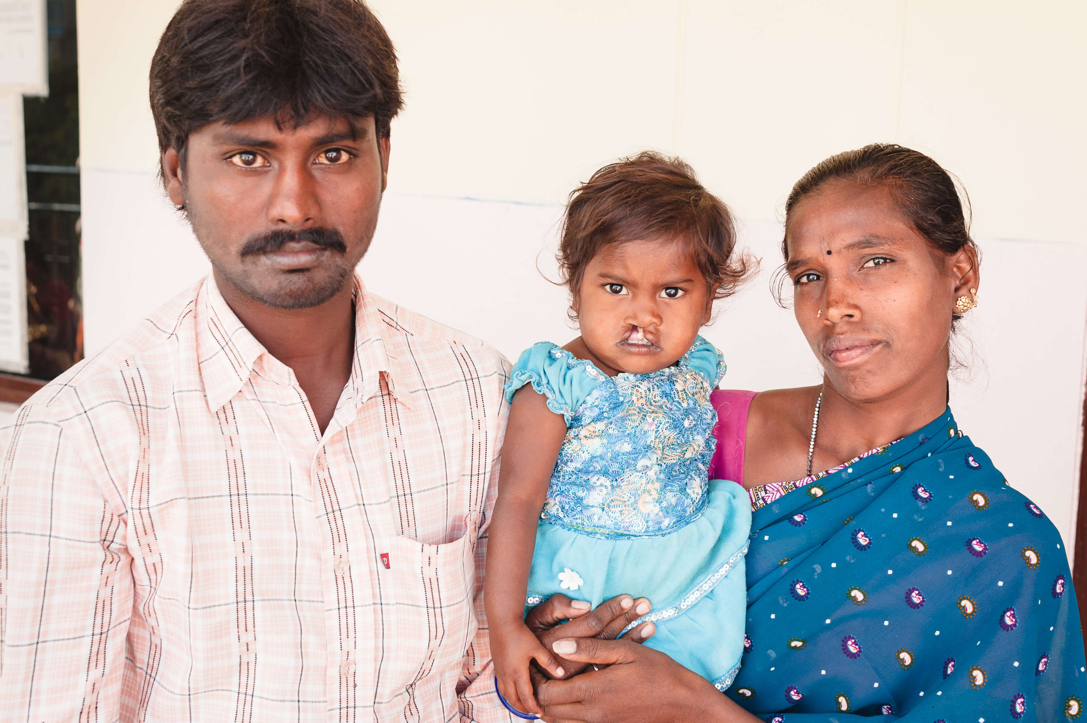 Cleft operation indien 4