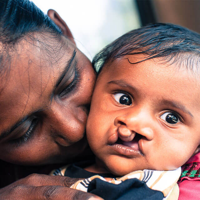 Portraits Cleft- Kinder und Betreuuer